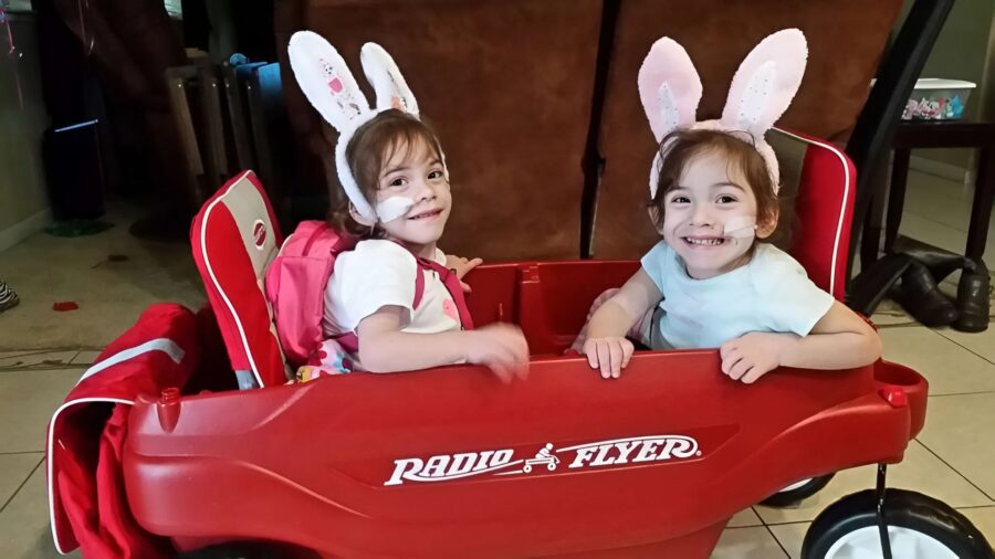 ორი სიამური და გადაურჩა მაღალრისკიან ოპერაციას და ახლა ცალ-ცალკე აგრძელებენ ცხოვრებას