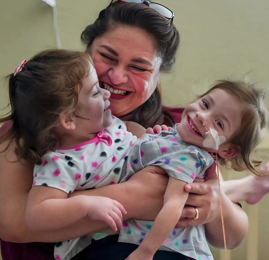 ორი სიამური და გადაურჩა მაღალრისკიან ოპერაციას და ახლა ცალ-ცალკე აგრძელებენ ცხოვრებას