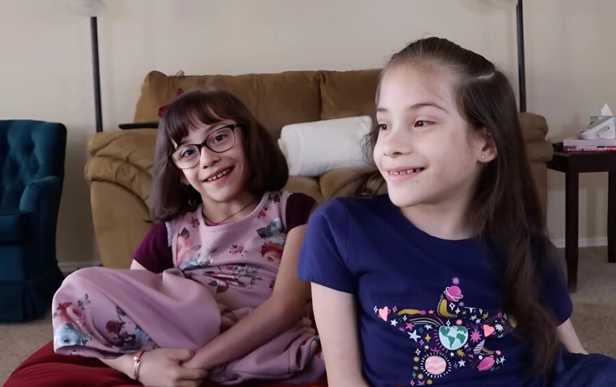 ორი სიამური და გადაურჩა მაღალრისკიან ოპერაციას და ახლა ცალ-ცალკე აგრძელებენ ცხოვრებას